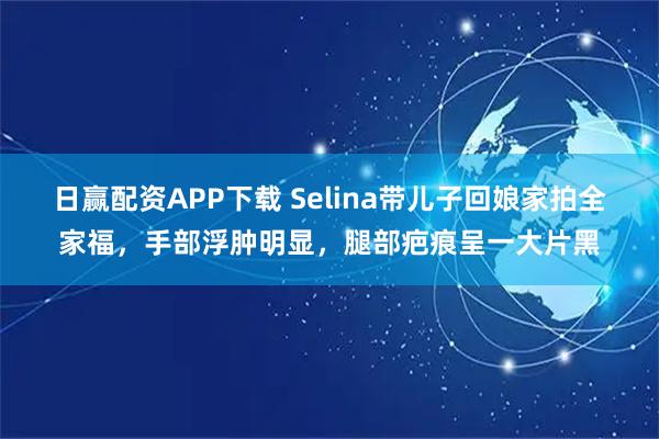 日赢配资APP下载 Selina带儿子回娘家拍全家福，手部浮肿明显，腿部疤痕呈一大片黑